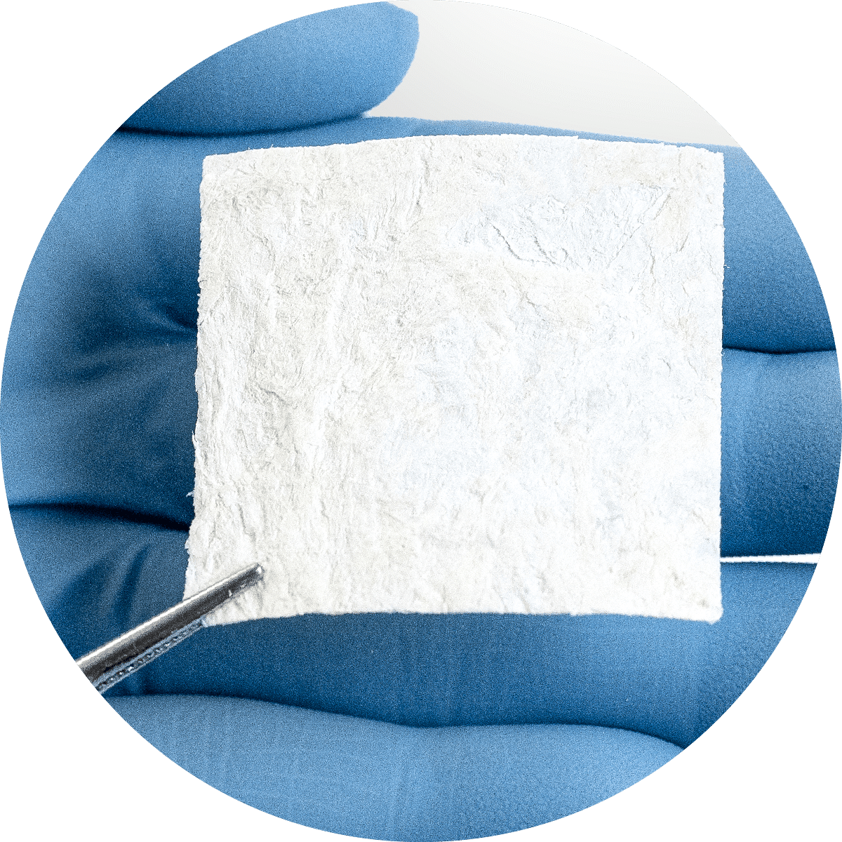 Vialize placental membrane held with forceps